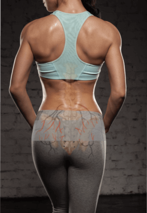 Blog-Image_When-an-SIJ-Belt-Causes-Pain_lowres-300x434